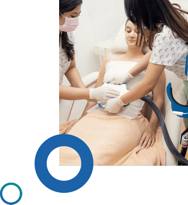 cryolipolysis