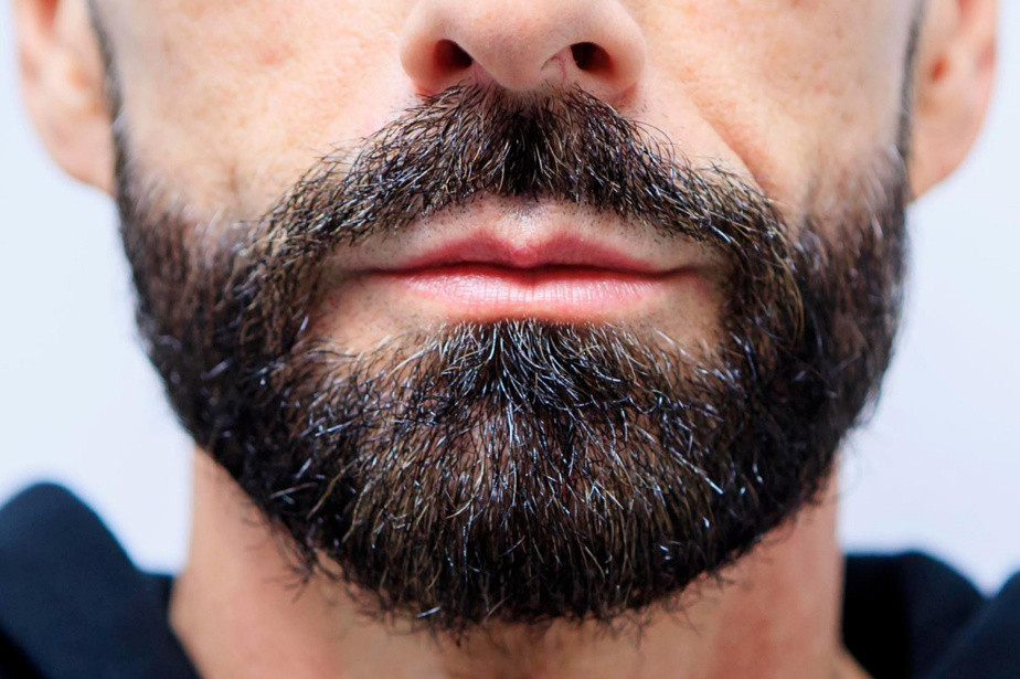 beard-transplant-tunisia