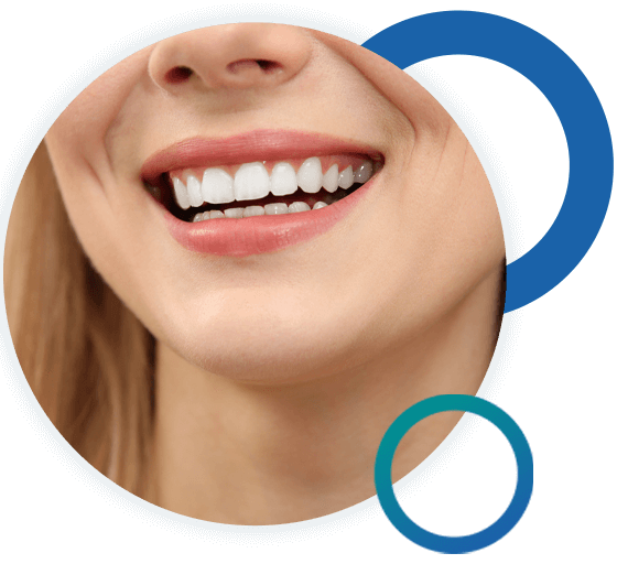 gingivectomy