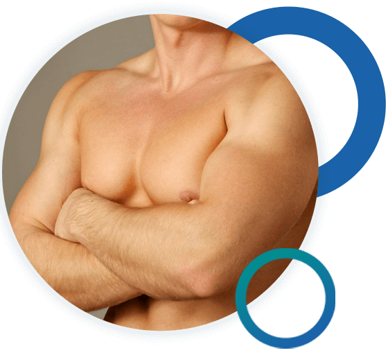 gynecomastia-surgery