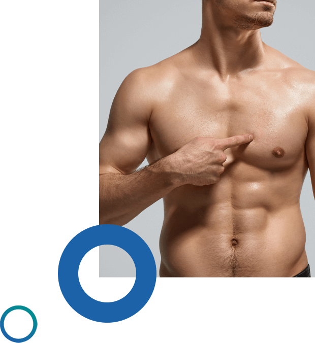 gynecomastia-surgery
