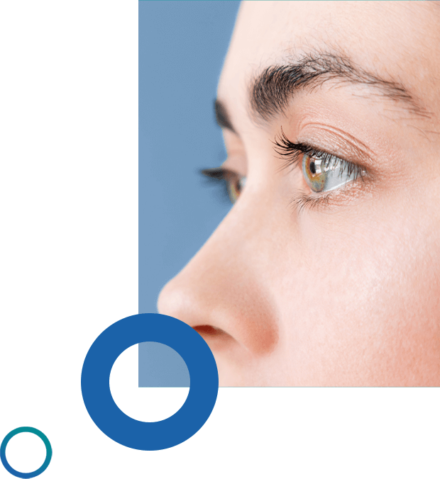 laser-eyelid-surgery